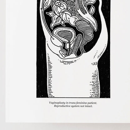 Trans Masc & Femme Anatomy | Transgender Art Print 2 Pack