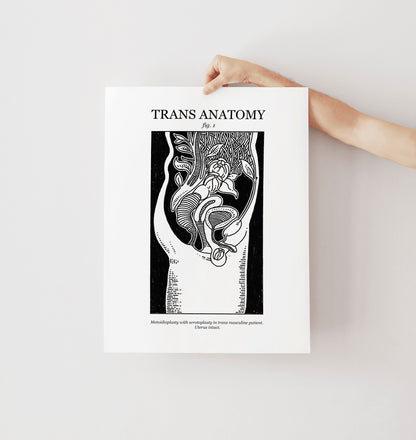 Trans Masc & Femme Anatomy | Transgender Art Print 2 Pack